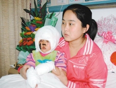 求助：男子澆汽油燒傷3歲女兒治療費難以為繼