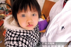 小朋友午休時講話遭幼師扔高跟鞋砸傷口鼻(圖